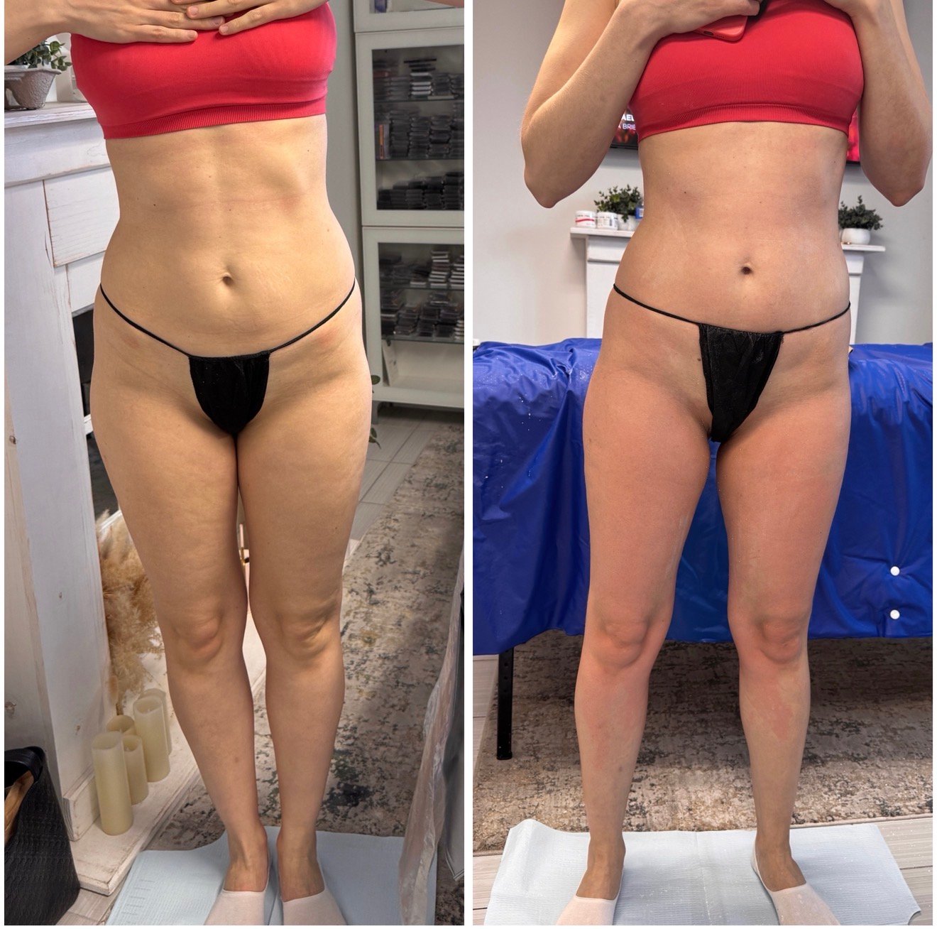 Gypsum Treatment before and after one treatment